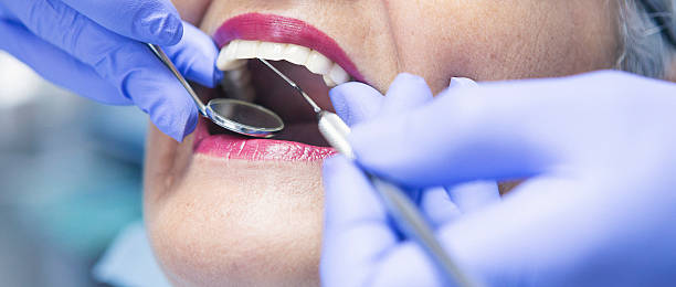 Best Emergency Wisdom Tooth Extraction in Lakeland, GA